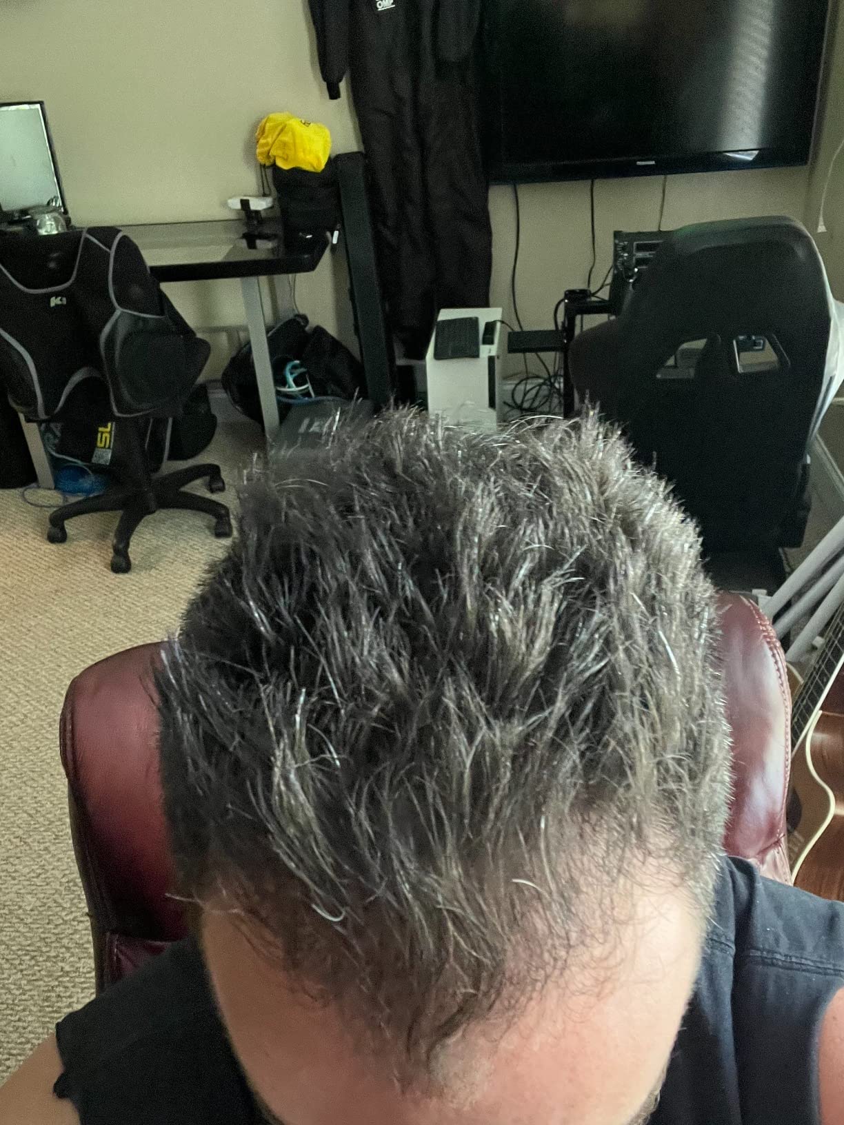iRestore Professional Laser Red Light Therapy for Hair Growth System - FDA Cleared Hair Loss, Hair Thinning & Alopecia Treatment for Men & Women - 282 Lasers & LEDs customer photo 2
