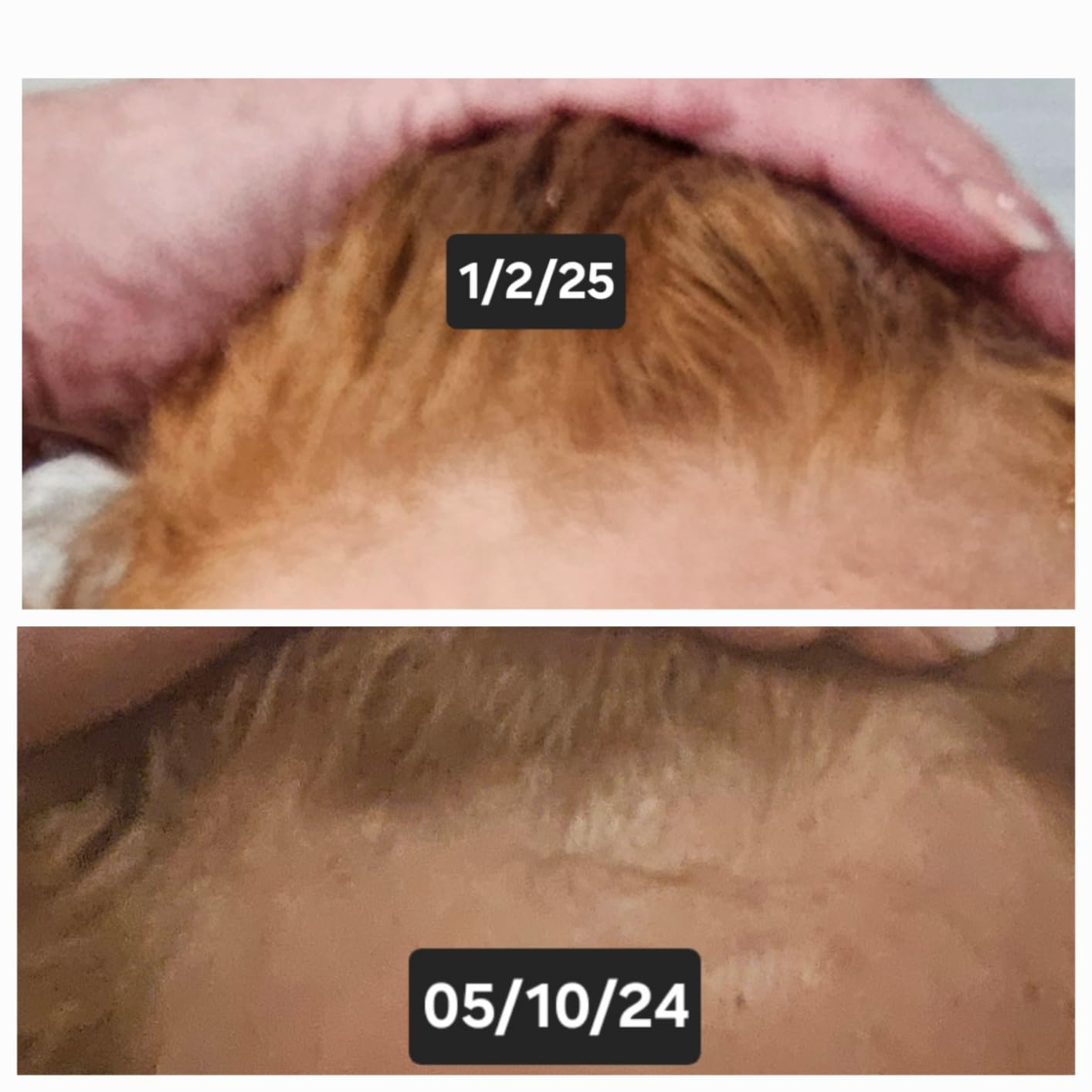 Instyle Egg Pro 80 Hair Growth Cap for Men & Women - Laser Hair Regrowth Device 80 Pro Lasers, 650nm Light Therapy, Hands-Free, Portable Cap for Thinning Hair, Full Scalp Coverage customer photo 1