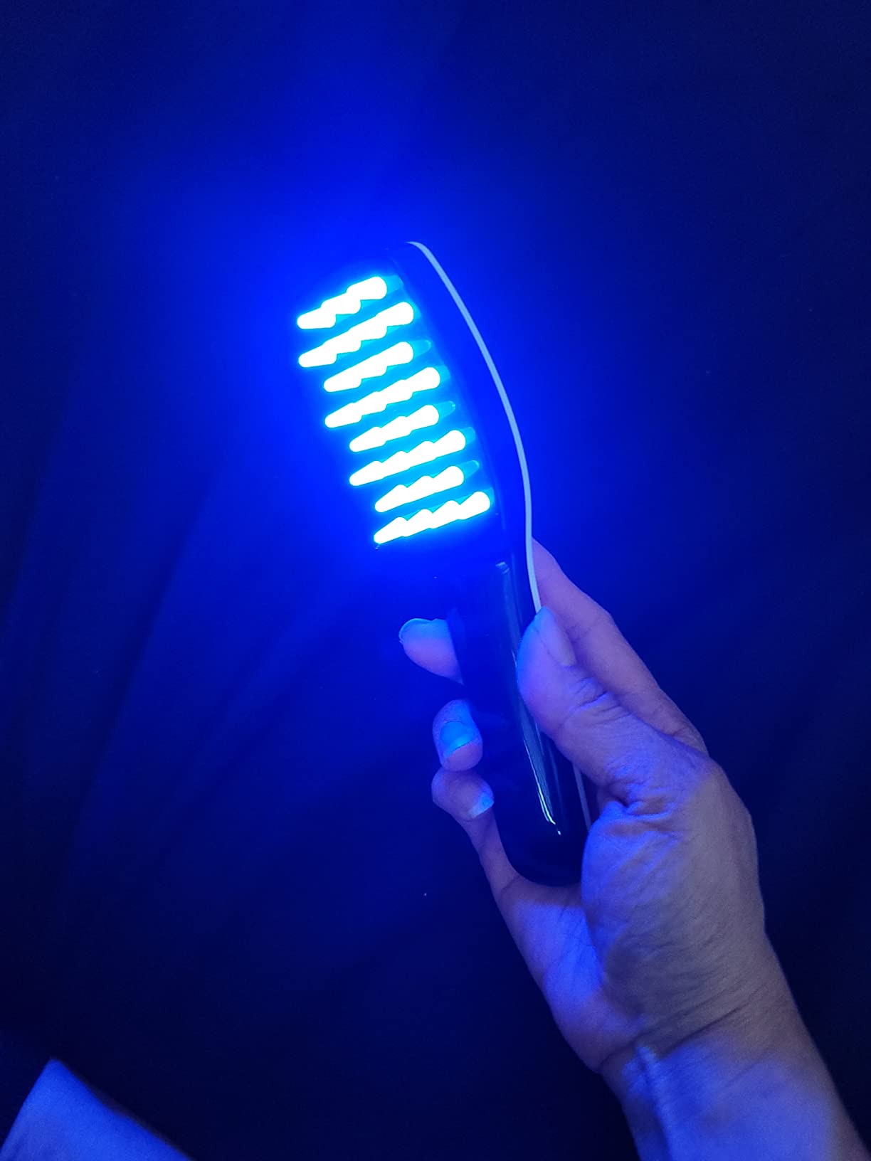 Winyoung Scalp Massager, Electric Scalp Massage Brush, Hair Massage Brush, Electric Head Scratcher, Massage Comb with Soft Rubber customer photo 1
