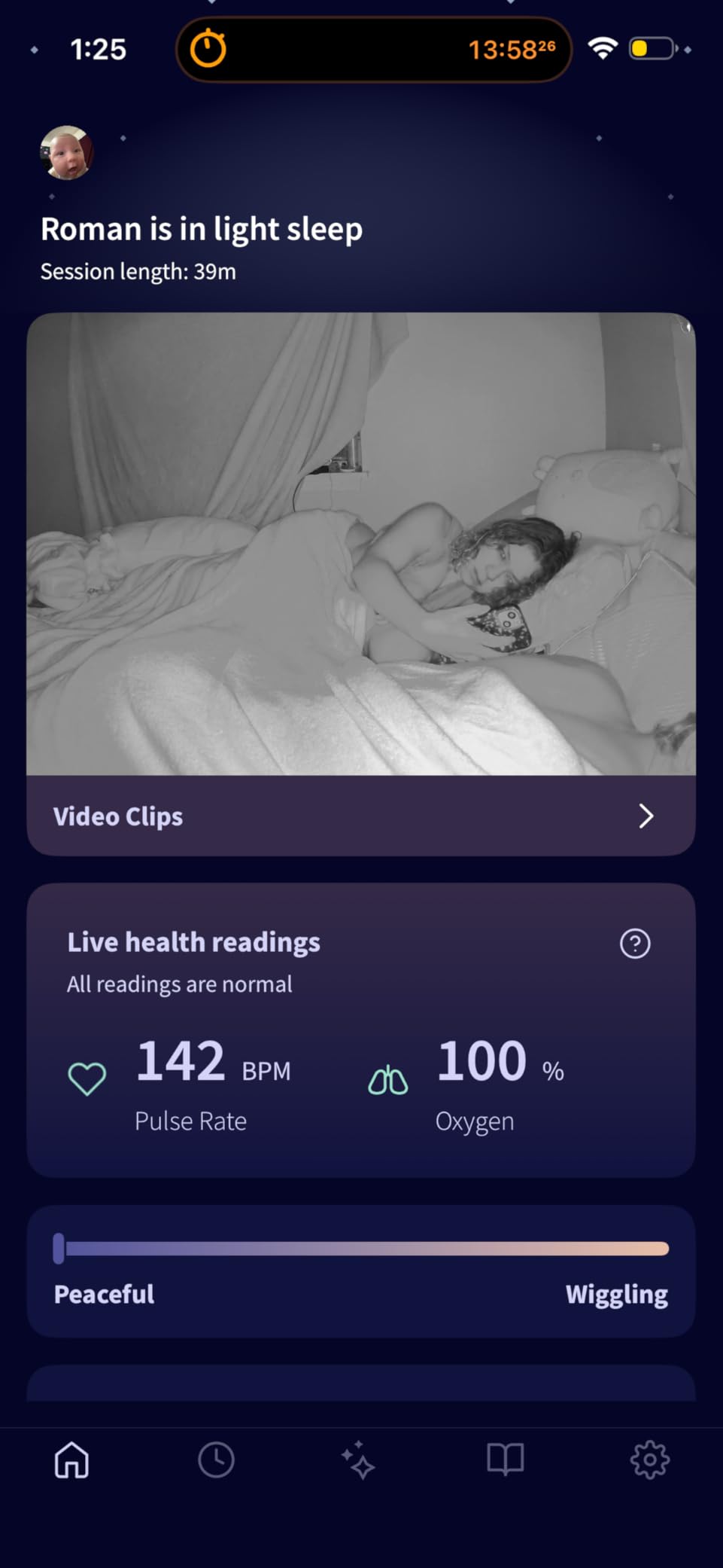 Owlet Dream Duo (Gen 3) Smart Baby Monitor All-in-One Bundle - 2K HD Video Baby Monitor with Alerts & Owlet Dream Sock Tracks Baby's Oxygen, Heart Rate & Sleep | Health Insights via App customer photo 1