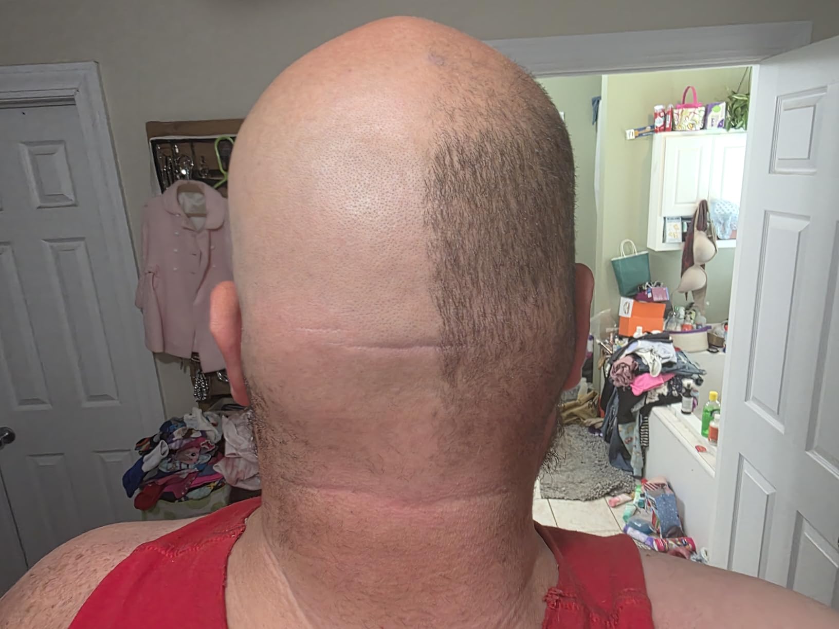 MANSCAPED® The Dome Shaver™ PRO Head Shaver for Bald Men customer photo 2